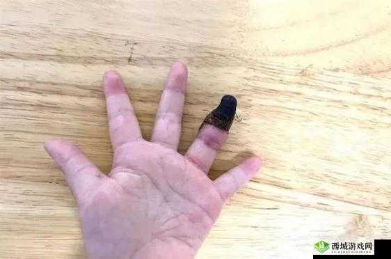 宝宝三根手指疼引发关注