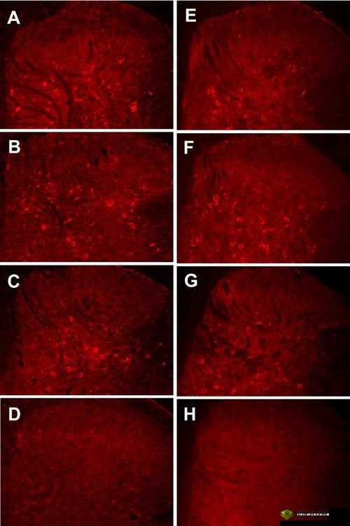 药效 1v2hpo 江漾治疗解析:深度探究与应用