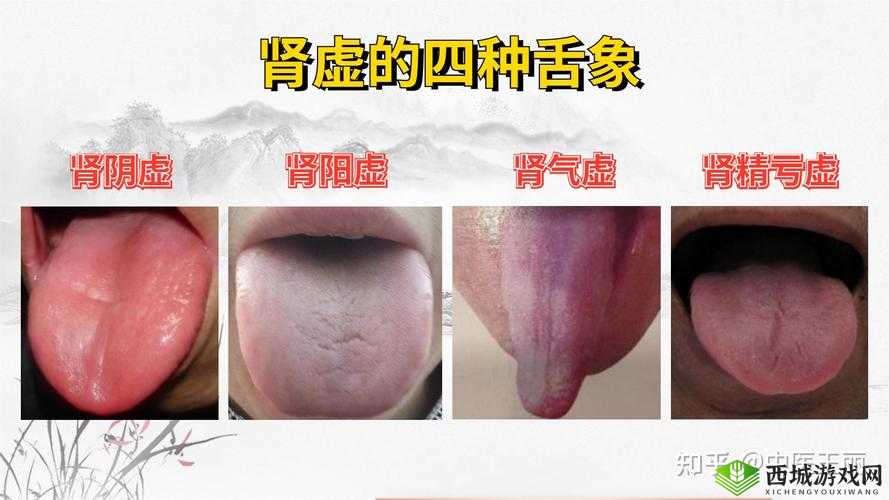 三分钟就完事了是不是肾虚：深度解析