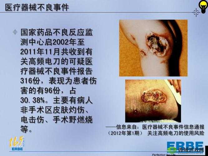 老中医用嘴排阴毒小雨:令人震惊的医疗事件