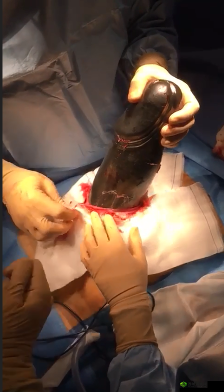 拔萝卜痛又降黄 9.1：奇特现象引发关注