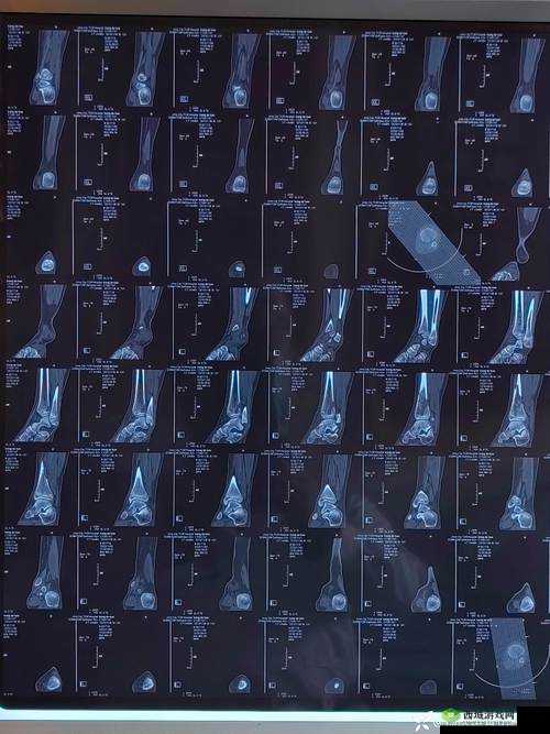 骨科 1v2h:独特的医疗领域