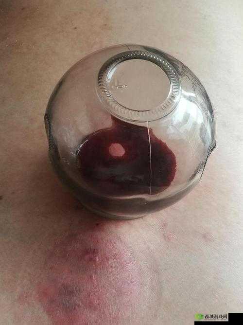 老中医李雪妮排阴毒疗法:是真是假