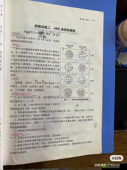 DayZ角色血型揭秘:血型检测方法与步骤详解