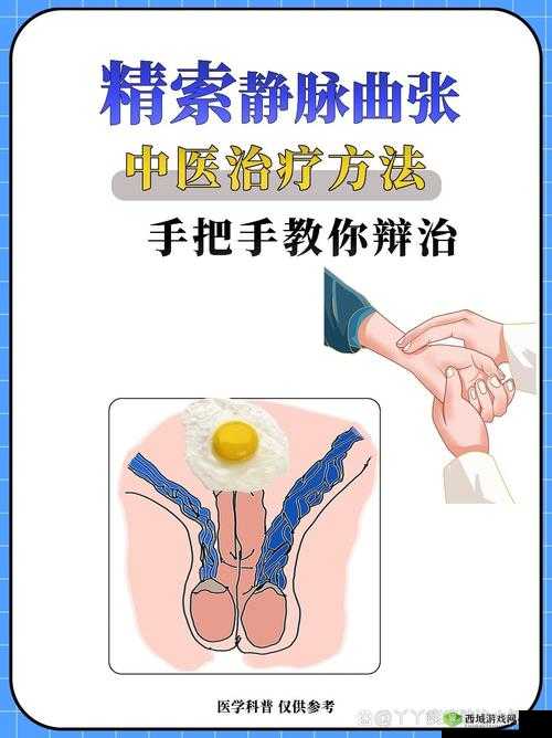 胡桃夹精索静脉曲张能治好吗:治疗前景分析