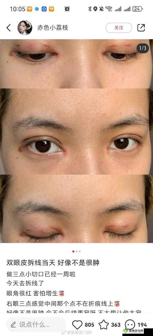 女生开过包以后会有什么样的变化：深度剖析