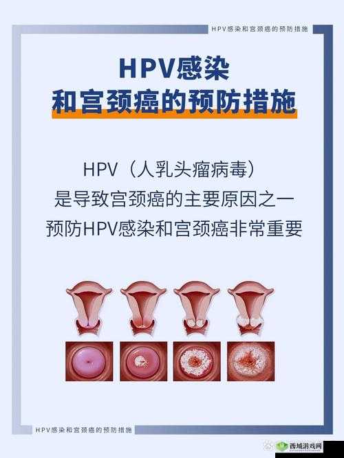 和几个人发生过关系才会得HPV:真相探究