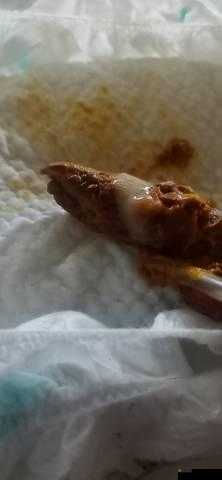 男生还没开始就有粘液是什么：这是正常的生理现象吗？