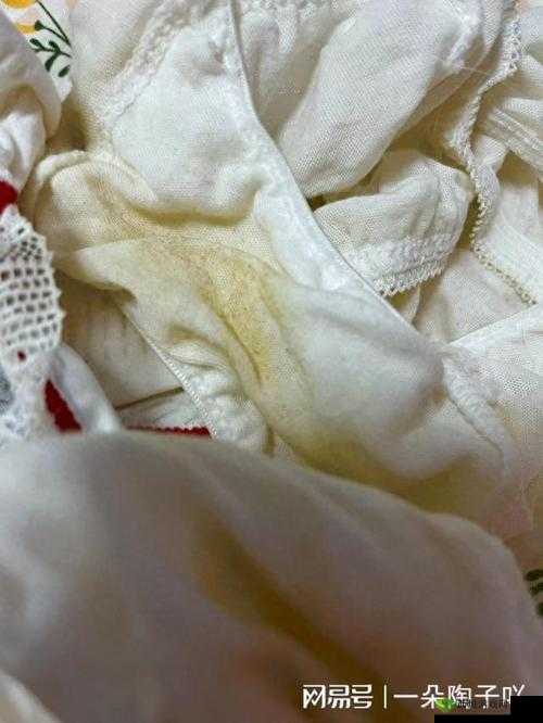 女生做完后流白色的分泌物是什么:其形成原因与具体表现