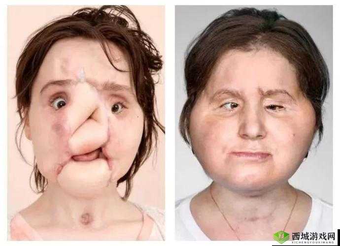 伽罗ちゃんへの手術名冪:深度解析与手术背后的故事