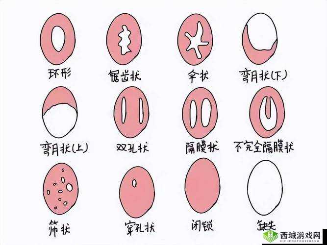 第一次性行为中,女性处女膜破裂导致的出血现象:性教育的重要性