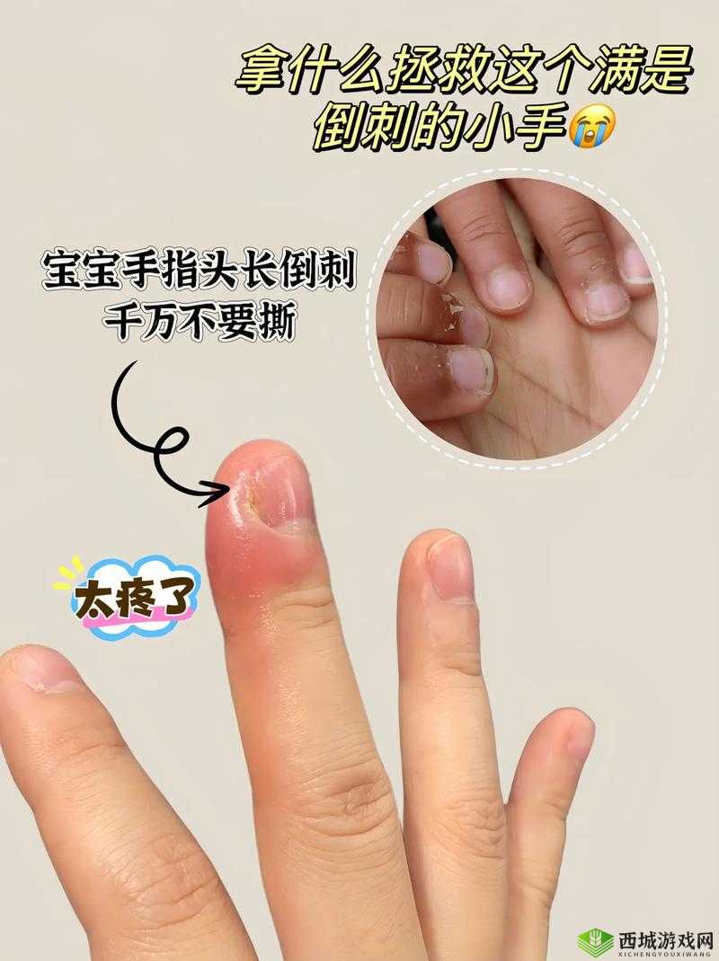 宝宝才两根手指就疼哭了:探究原因与解决方法