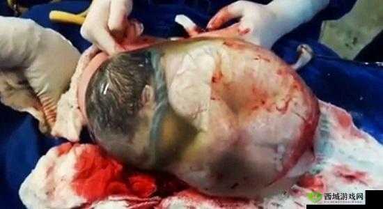 大肚美人生产双胞,奇妙孕育奇迹诞生