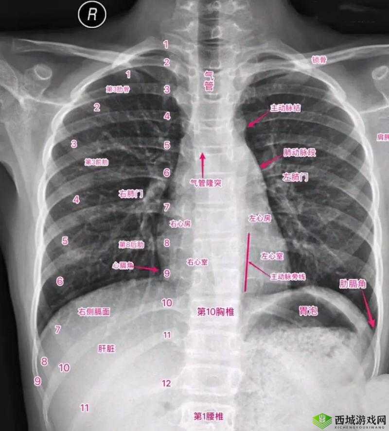 十大曝光胸片:揭示医疗影像背后的不为人知故事