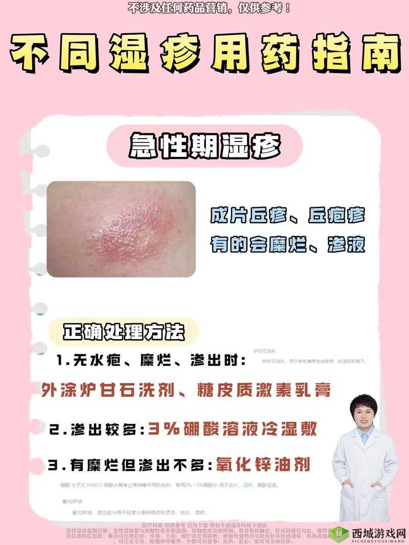 淑芬两腿间又痒了 50 年,私密处为何总是瘙痒难耐?