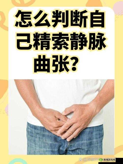 胡桃夹精索静脉曲张能治好吗：患者关心的重要问题探讨