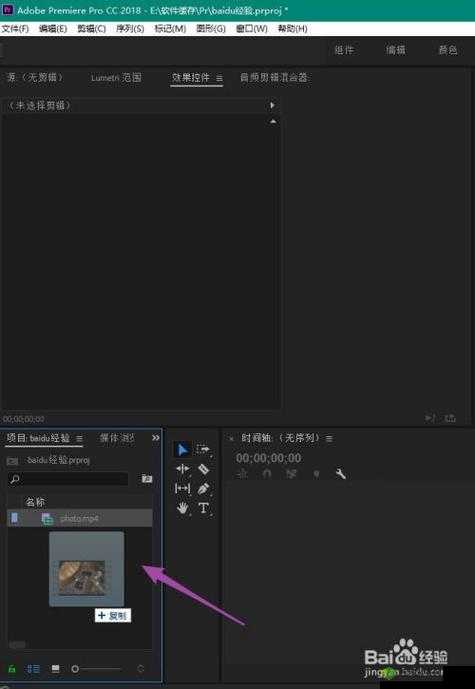 100% 胸片曝光率软件:可直接查看超便捷