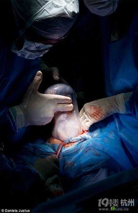 BBW 分娩 freeHD：见证生命诞生的奇迹