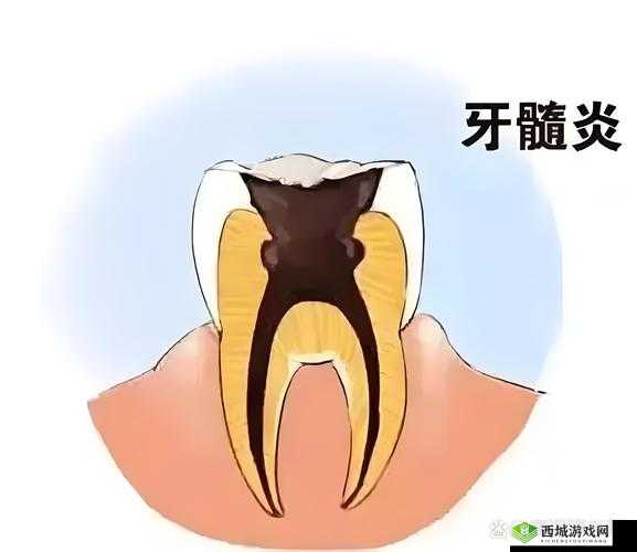 2023 钙 Ggy 为啥没有了:探究背后的原因