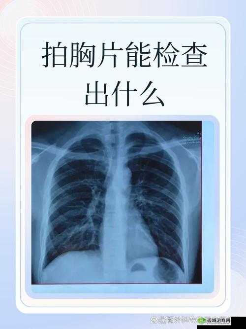 100%胸片曝光率免费:的健康检查保驾护航