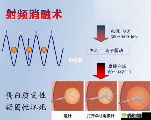 433MHz射频技术对人体健康有影响吗?其安全性与潜在风险