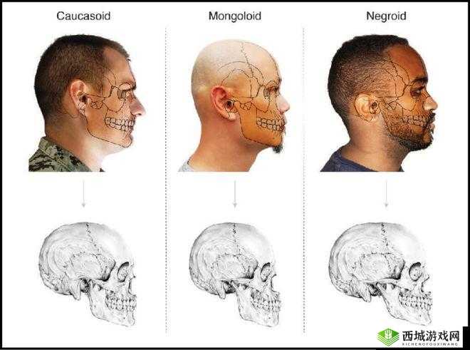 亚洲人vs欧洲人基因差别揭秘:从肤色到疾病易感性的科学解析