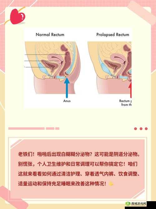 啪啪时流出白色液体是什么原因？专家解析健康隐患与应对方法