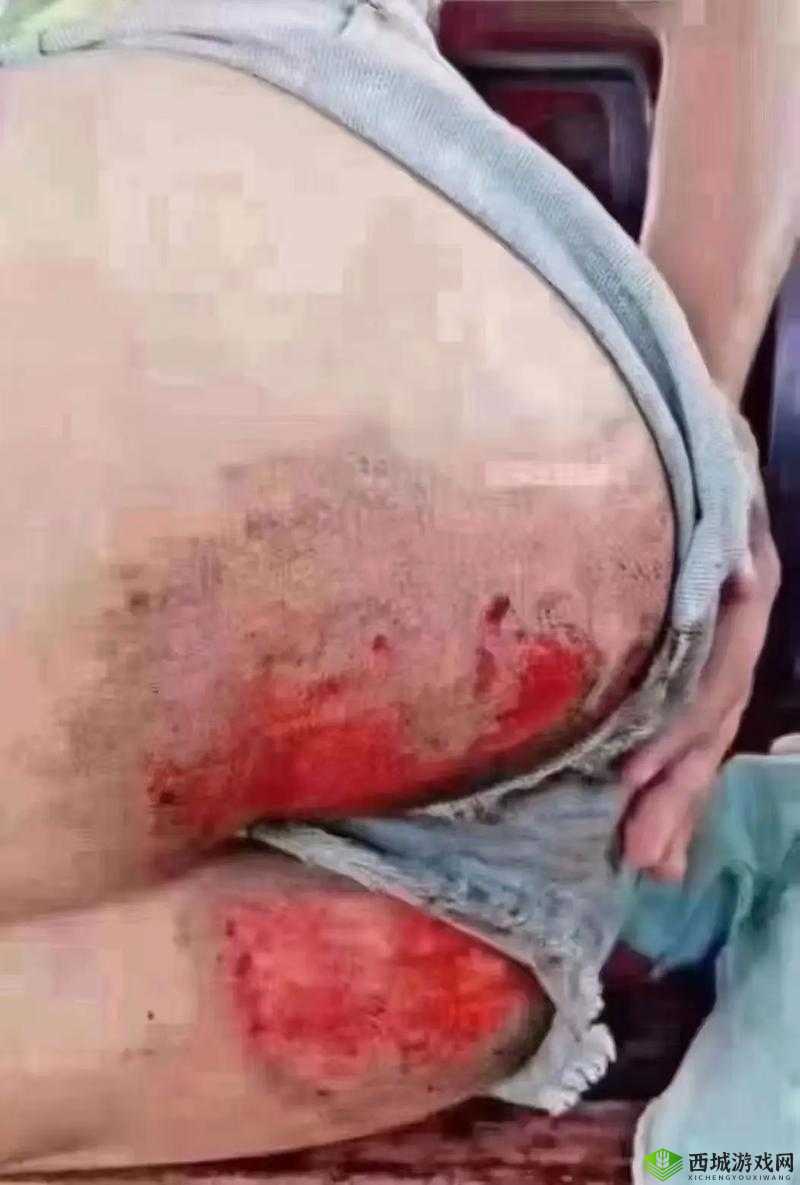 女人夹冰块扒开屁股被打:揭秘背后的真相与健康风险