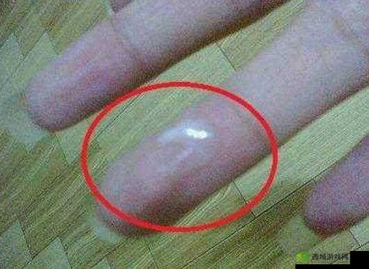 为什么同房后女性会分泌白色分泌物？这种情况正常吗？