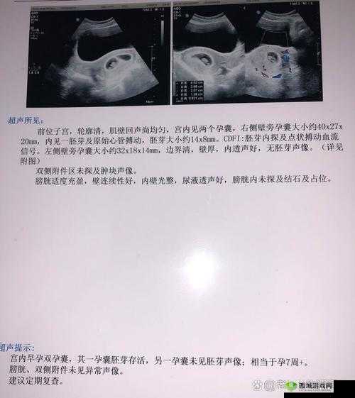 婵云吧多胎生产是怎么回事?为何多胎生产引发广泛关注?