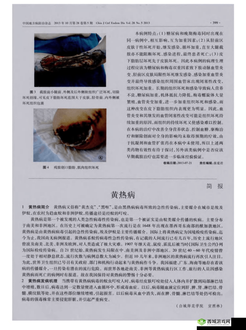 希望之村黄热病怎么治？黄热病治疗处理方法介绍及未来玩法革命预测